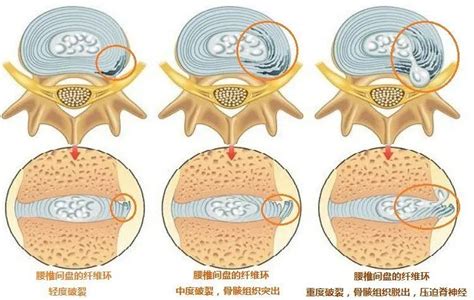 突出 凸出|突出和凸出的区别语文